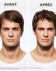 Avant/ Après utilisation Genesis-Homme Kérastase