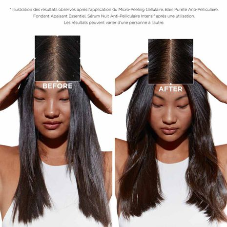 Avant/ Après utilisation Bain Pureté Anti-Pelliculaire Symbiose  Kérastase