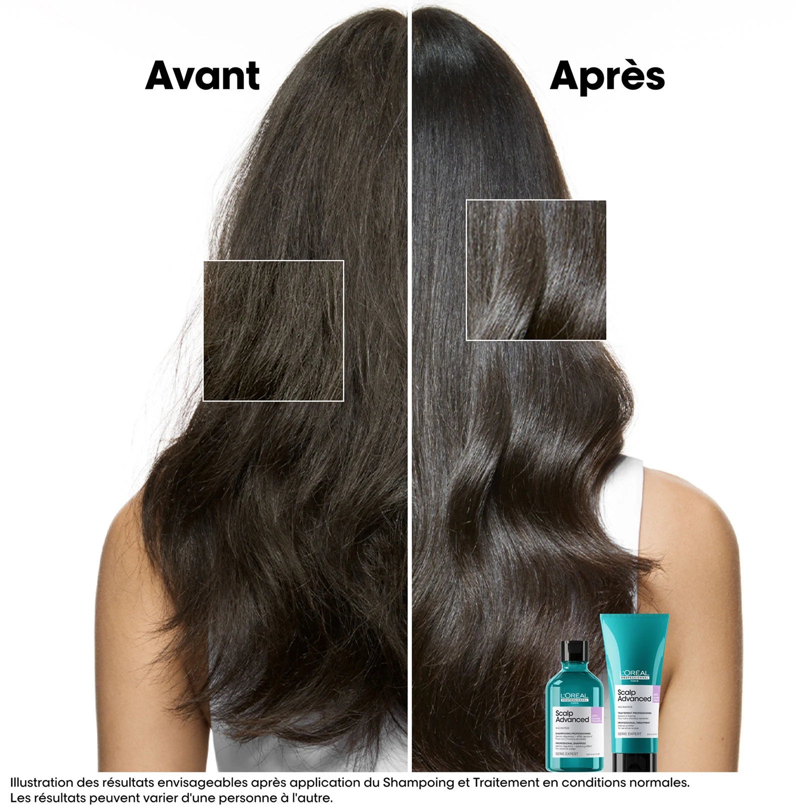 Avant/ Après utilisation Scalp Advanced L’Oréal
